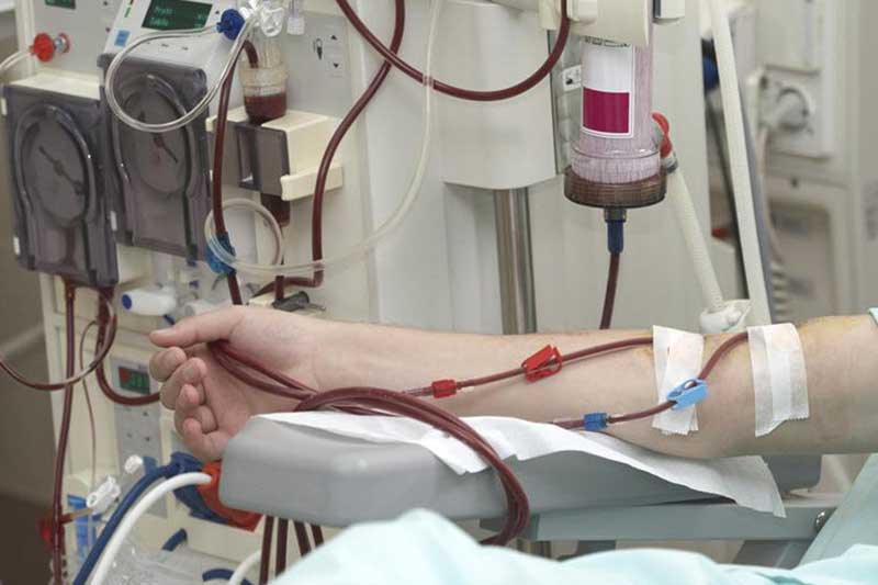 KIDNEY-DISEASE-DIALYSIS